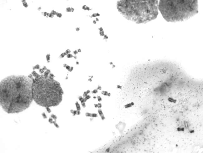 TCC-1.4HICE染色體圖片