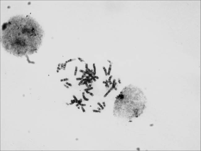 彩色轉黑白拍攝染色體