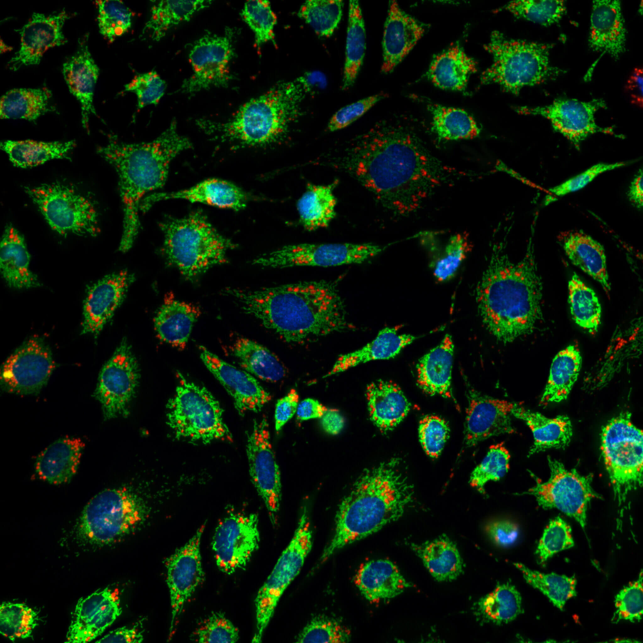 高內(nèi)涵成像