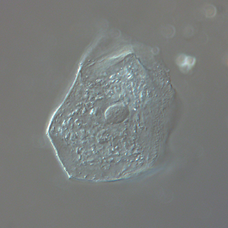 DIC Microscoy