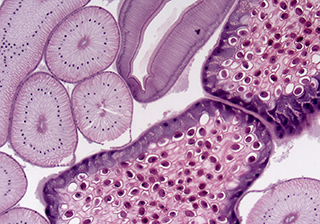 醫(yī)療病理組織